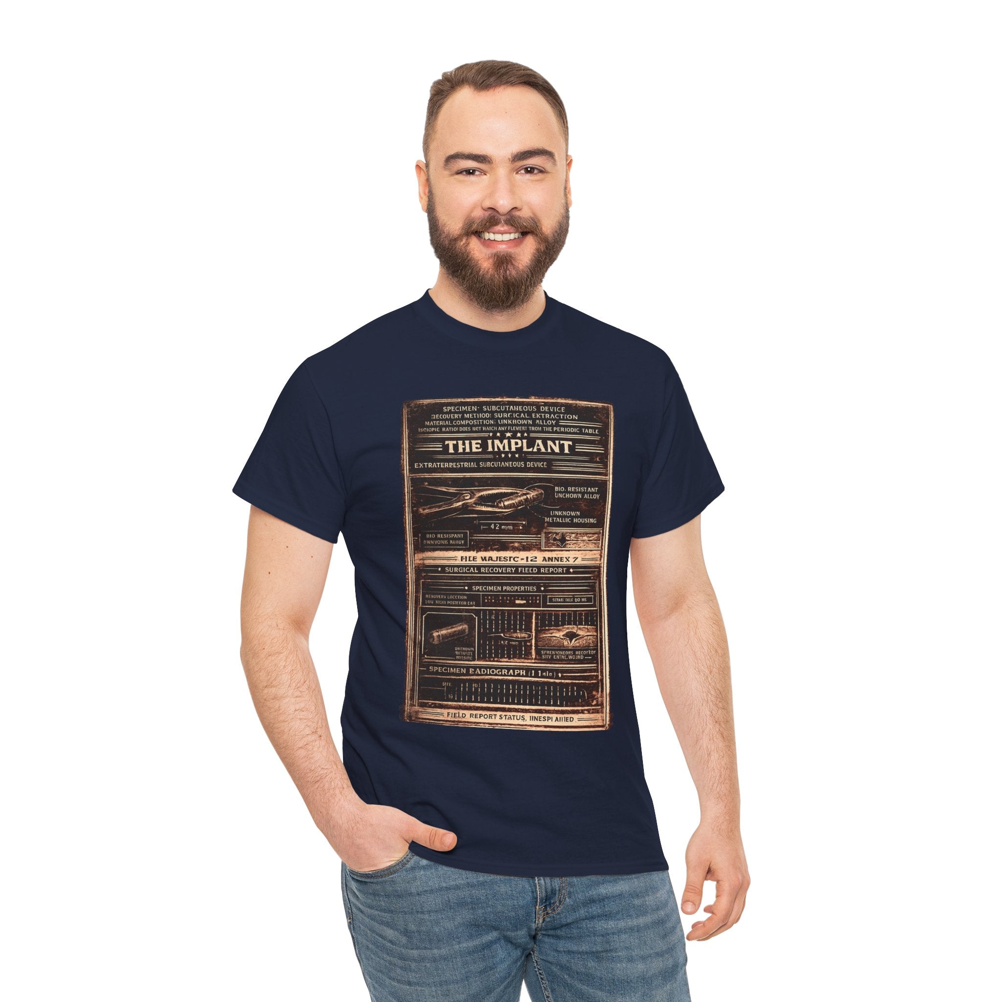 The Implant – Extraterrestrial Subcutaneous Device Surgical Recovery Field Report Vintage Graphic T-Shirt